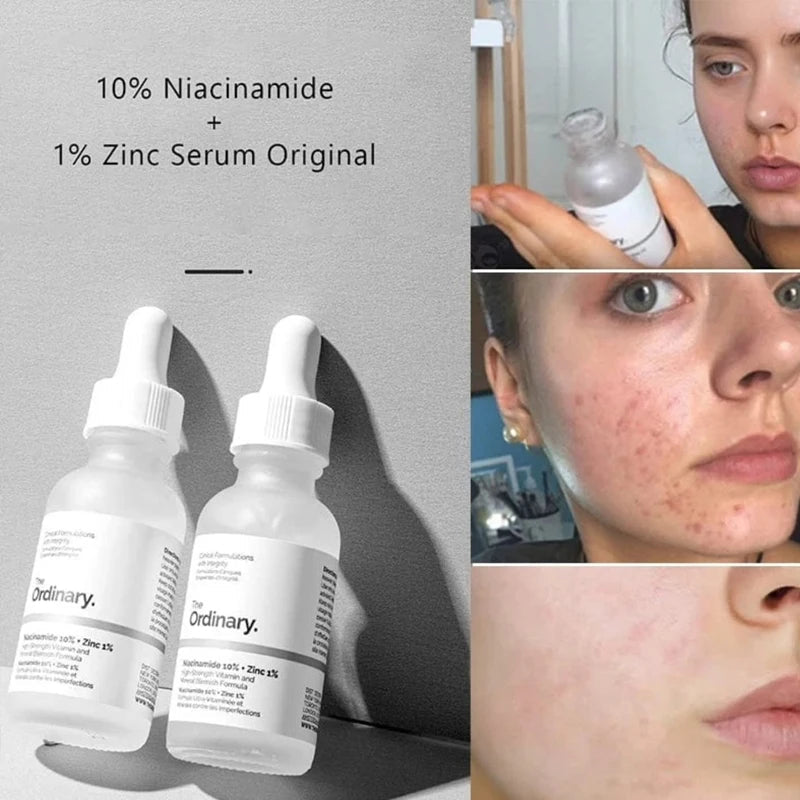 The Ordinary Niacinamide 10% + Zinc 1%