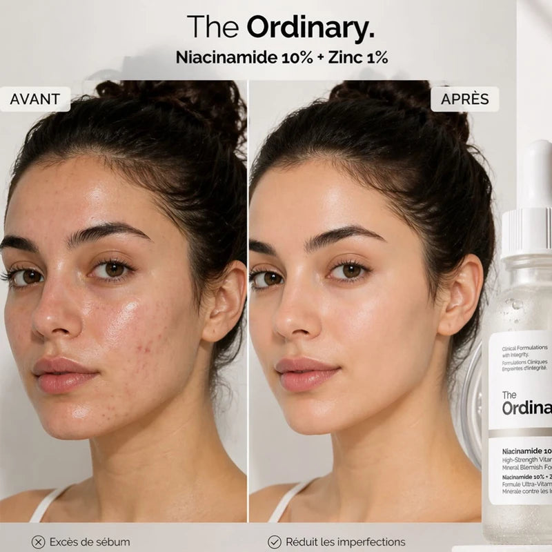 The Ordinary Niacinamide 10% + Zinc 1%