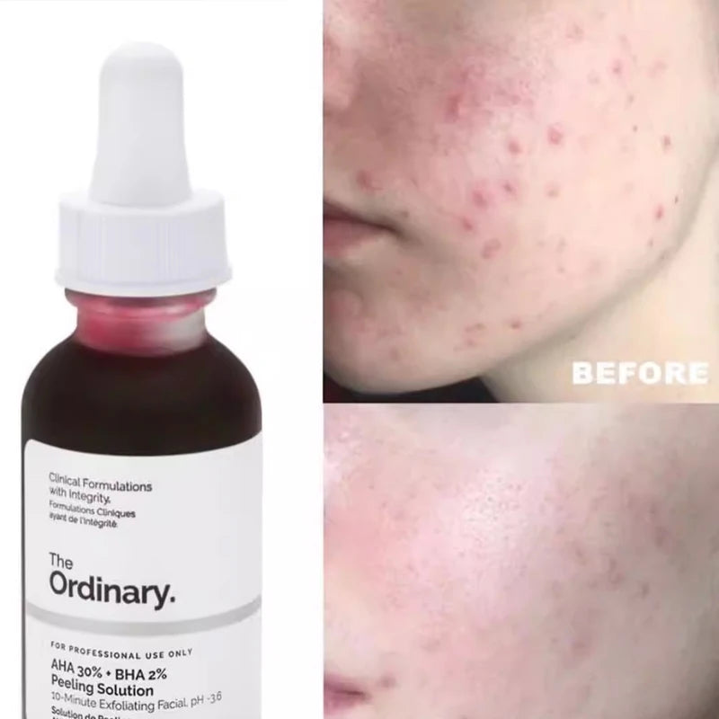 The Ordinary AHA 30% + BHA 2% Peeling Solution