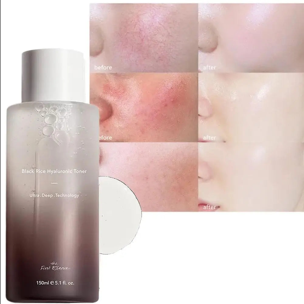 Haruharu Wonder Black Rice Toner cu Acid Hialuronic