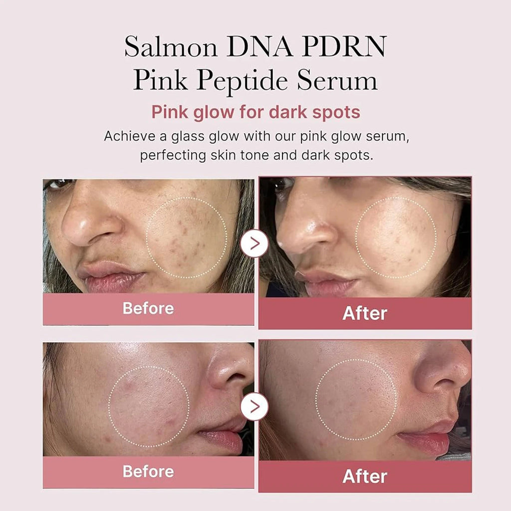 Medicube Salmon DNA PDRN Pink Peptide Serum