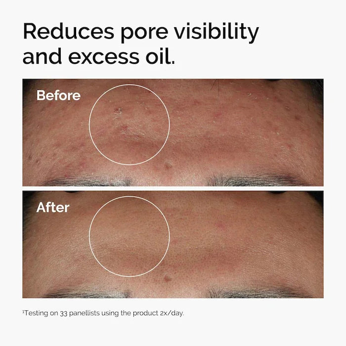 The Ordinary Niacinamide