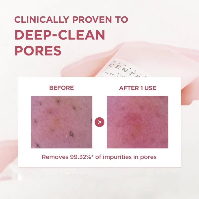 SKIN1004 Centella Poremizing Deep Cleansing Foam