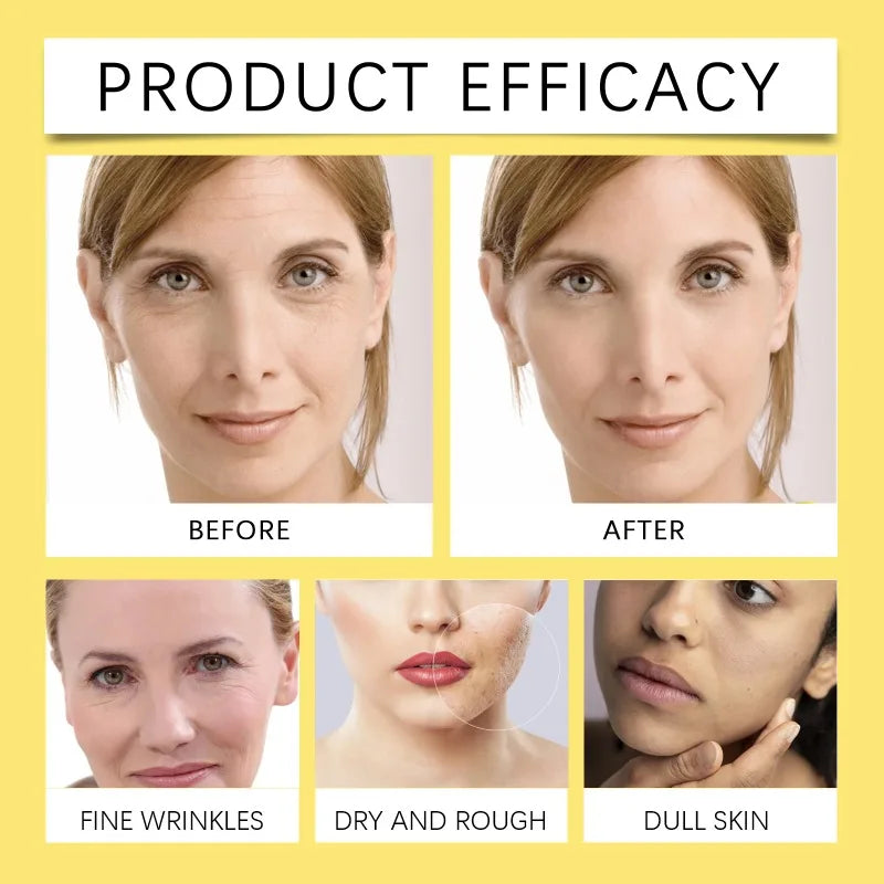Snail 92 Mucin Power Cream 100g