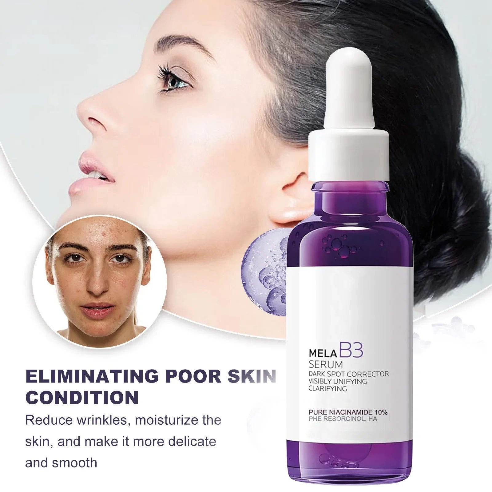 Ser Niacinamide 10% (Vitamina B3)