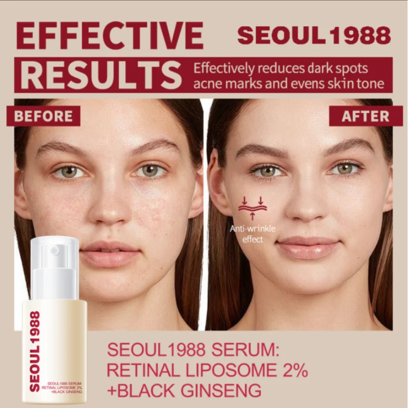 Seoul 1988 Skincare – Cremă Ochi Retinol, Esență Apă, Cremă Colagen, Esență Retinol & Cremă Orez | Korean Skincare | Feminin