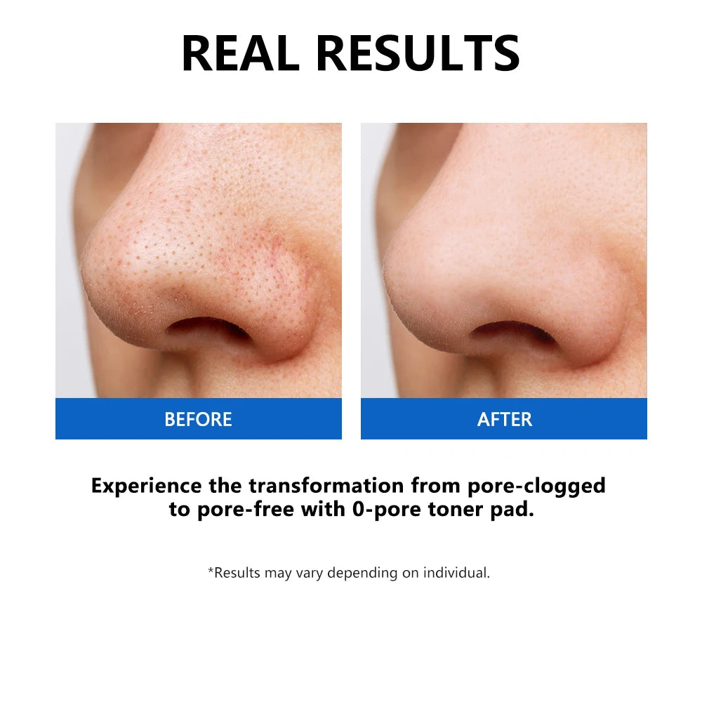 Lakerain Zero Pore Toner Pads