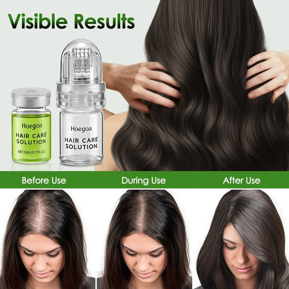 1/2/3 Boxes HailEssential Care Serum strengthen roots Reducing Loss Prevent Baldness Nourishing Regrow Hair Care Essence