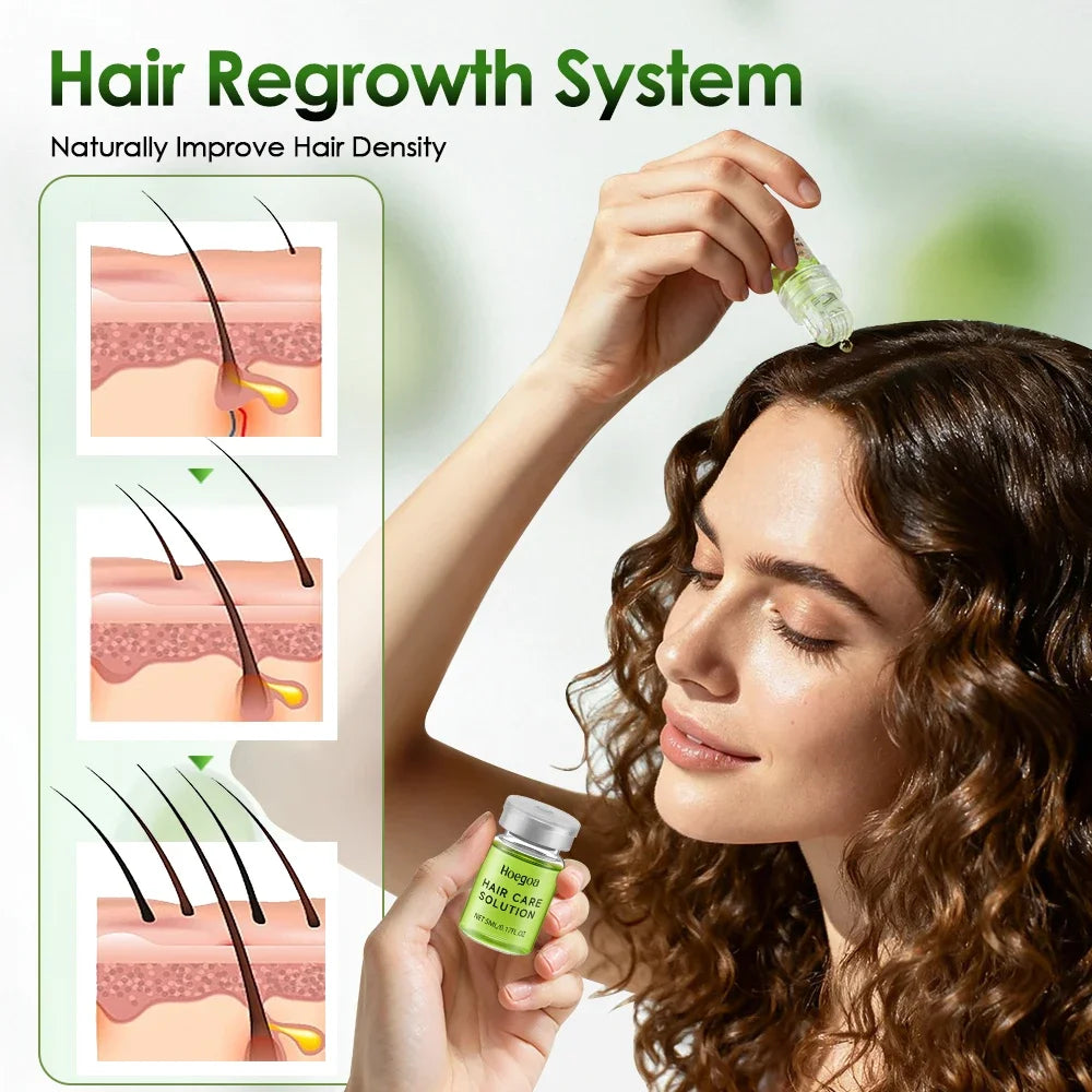 1/2/3 Boxes HailEssential Care Serum strengthen roots Reducing Loss Prevent Baldness Nourishing Regrow Hair Care Essence